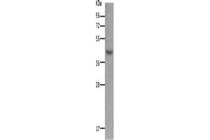 Western Blotting (WB) image for anti-Melanocortin 5 Receptor (MC5R) antibody (ABIN2431635) (MC5 Receptor antibody)