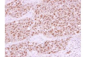 Immunohistochemistry (IHC) image for anti-RAD21 Homolog (RAD21) (Center) antibody (ABIN2856242)