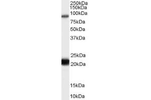 Image no. 1 for anti-RAS Protein Activator Like 1 (GAP1 Like) (RASAL1) (C-Term) antibody (ABIN375234)