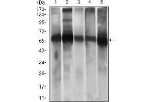 Western blot analysis using ALDH2 mouse mAb against HepG2 (1), A549 (2) cell lysate, and Rat live (3), Mouse liver (4), Mouse brain (5) tissue lysate. (ALDH2 antibody  (AA 317-517))