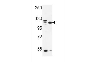 Western blot analysis in MDA-MB435,MCF-7 cell line lysates (35ug/lane). (SEC24C antibody  (AA 443-470))