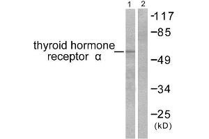 Western Blotting (WB) image for anti-Thyroid Hormone Receptor, alpha (THRA) (N-Term) antibody (ABIN1848805) (THRA antibody  (N-Term))