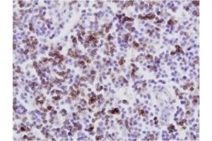 Immunohistochemistry (IHC) image for anti-CD8 (CD8) antibody (ABIN1449140) (CD8 antibody)