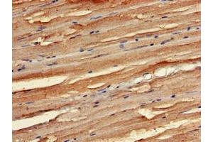 Immunohistochemistry of paraffin-embedded human skeletal muscle tissue using ABIN7168997 at dilution of 1:100 (STK35 antibody  (AA 1-200))