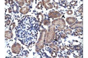 Image no. 1 for anti-B-Cell CLL/lymphoma 2 (BCL2) (AA 54-103) antibody (ABIN6735914) (Bcl-2 antibody  (AA 54-103))