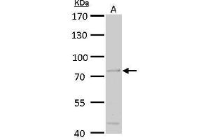 WB Image ACOX3 antibody detects ACOX3 protein by Western blot analysis. (ACOX3 antibody  (C-Term))