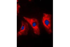Immunofluorescent analysis of Vimentin staining in MCF7 cells.