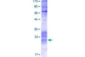 SDS-PAGE (SDS) image for CD276 (CD276) (AA 28-140) protein (His-DYKDDDDK-Strep II Tag) (ABIN4369856) (CD276 Protein (CD276) (AA 28-140) (His-DYKDDDDK-Strep II Tag))
