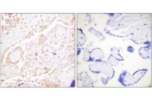 Immunohistochemistry analysis of paraffin-embedded human placenta tissue, using GATA3 (Ab-308) Antibody.