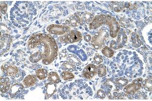 Human kidney (DCTPP1 antibody  (Middle Region))
