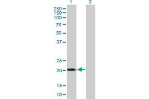 Western Blot analysis of IFNA10 expression in transfected 293T cell line by IFNA10 MaxPab polyclonal antibody.