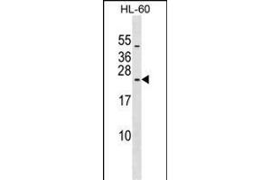RPL10L Antibody (N-term) (ABIN1539610 and ABIN2849193) western blot analysis in HL-60 cell line lysates (35 μg/lane). (RPL10L antibody  (N-Term))