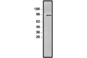Image no. 1 for anti-Solute Carrier Family 9, Subfamily A (NHE1, Cation Proton Antiporter 1), Member 1 (SLC9A1) antibody (ABIN265248) (SLC9A1 antibody)