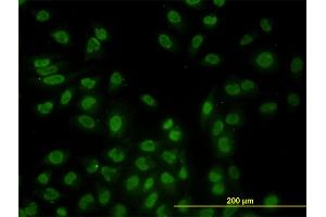 Immunofluorescence of monoclonal antibody to STK17B on HeLa cell. (DRAK2 antibody  (AA 272-372))