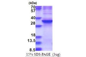 SDS-PAGE (SDS) image for Zinc Finger Protein 32 (ZNF32) (AA 1-273) protein (His tag) (ABIN5853740) (ZNF32 Protein (AA 1-273) (His tag))