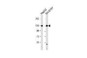 All lanes : Anti-RENT1 Antibody (N-term E22) at 1:1000 dilution Lane 1: HepG2 whole cell lysate Lane 2: SH-SY5Y whole cell lysate Lysates/proteins at 20 μg per lane. (RENT1/UPF1 antibody  (N-Term))