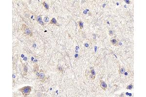 Immunohistochemistry analysis of paraffin-embedded mouse spinal marrow using DLL3 Polyclonal Antibody at dilution of 1:300. (DLL3 antibody)