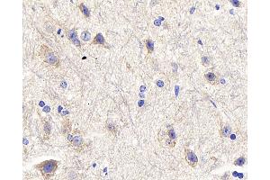 Immunohistochemistry analysis of paraffin-embedded mouse spinal marrow using DLL3 Polyclonal Antibody at dilution of 1:300.