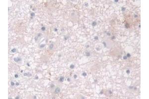 Immunohistochemistry (IHC) image for anti-Cellular Retinoic Acid Binding Protein 2 (CRABP2) (AA 1-138) antibody (ABIN7435991)