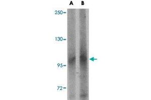 Western blot analysis of LRFN1 in human brain tissue lysate with LRFN1 polyclonal antibody  at (A) 1 and (B) 2 ug/mL .