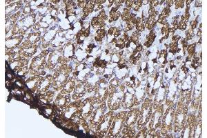 ABIN6277510 at 1/100 staining Human gastric tissue by IHC-P.