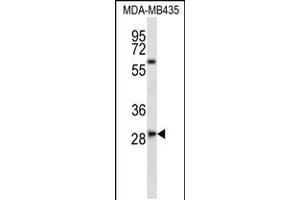Western blot analysis in MDA-MB435 cell line lysates (35ug/lane). (SLAMF8 antibody  (C-Term))