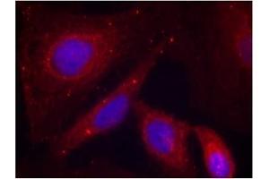Image no. 3 for anti-P21-Activated Kinase 1 (PAK1) (pThr212) antibody (ABIN196879) (PAK1 antibody  (pThr212))