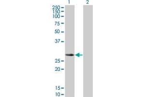 Western Blot analysis of SLA2 expression in transfected 293T cell line by SLA2 monoclonal antibody (M01), clone 3G5. (SLAP2 antibody  (AA 1-261))