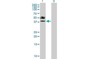 Western Blot analysis of ST6GALNAC6 expression in transfected 293T cell line by ST6GALNAC6 MaxPab polyclonal antibody. (ST6GALNAC6 antibody  (AA 1-333))