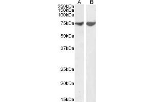 ABIN6391395 (1µg/ml) staining of Human Amygdala (A) and Cerebellum (B) lysate (35µg protein in RIPA buffer). (MAPK8IP1 antibody  (AA 265-279))