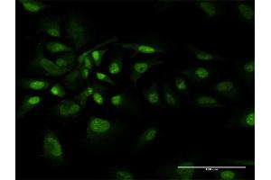 Immunofluorescence of purified MaxPab antibody to BAG1 on HeLa cell. (BAG1 antibody  (AA 1-274))