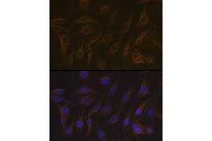Immunofluorescence analysis of C6 cells using EB3/M Rabbit mAb (ABIN7268535) at dilution of 1:100 (40x lens). (MAPRE3 antibody)