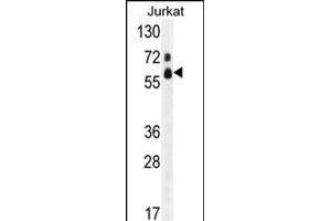 Western blot analysis of hFASTK- (ABIN391120 and ABIN2841247) in Jurkat cell line lysates (35 μg/lane). (FASTK antibody  (C-Term))