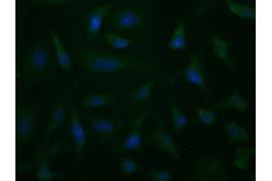 Image no. 3 for anti-Aldehyde Dehydrogenase 1 Family, Member L1 (ALDH1L1) antibody (ABIN1496581) (ALDH1L1 antibody)
