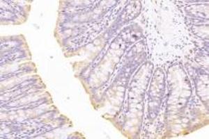 Immunohistochemistry (Paraffin-embedded Sections) (IHC (p)) image for anti-5'-Nucleotidase, Cytosolic IB (NT5C1B) antibody (ABIN7072861)