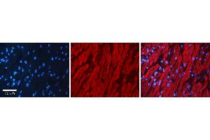 Rabbit Anti-AKR1C3 Antibody Catalog Number: ARP61430_P050 Formalin Fixed Paraffin Embedded Tissue: Human heart Tissue Observed Staining: Cytoplasmic Primary Antibody Concentration: 1:100 Other Working Concentrations: N/A Secondary Antibody: Donkey anti-Rabbit-Cy3 Secondary Antibody Concentration: 1:200 Magnification: 20X Exposure Time: 0. (AKR1C3 antibody  (N-Term))