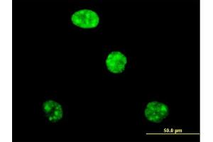 Immunofluorescence of purified MaxPab antibody to ADAR on HeLa cell.