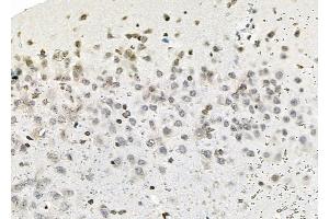 ABIN6263687 and ABIN6279632 at 1/100 staining Rat brain tissue by IHC-P. (NOL7 antibody  (C-Term))