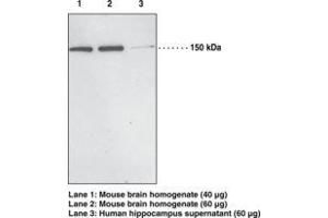 Image no. 1 for anti-PH Domain and Leucine Rich Repeat Protein Phosphatase 1 (PHLPP1) antibody (ABIN2451738) (PHLPP1 antibody)