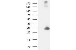 Western Blotting (WB) image for anti-Deoxycytidine Kinase (DCK) antibody (ABIN1497773)