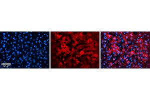 Rabbit Anti-EIF4G2 Antibody   Formalin Fixed Paraffin Embedded Tissue: Human Liver Tissue Observed Staining: Cytoplasm in hepatocytes Primary Antibody Concentration: N/A Other Working Concentrations: 1:600 Secondary Antibody: Donkey anti-Rabbit-Cy3 Secondary Antibody Concentration: 1:200 Magnification: 20X Exposure Time: 0. (EIF4G2 antibody  (C-Term))