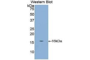 Detection of Recombinant CUBN, Mouse using Polyclonal Antibody to Cubilin (CUBN) (CUBN antibody  (AA 3157-3274))
