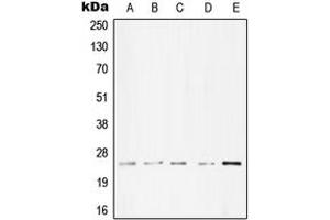 Western blot analysis of cTnI expression in A431 (A), Molt4 (B), A549 (C), NIH3T3 (D), PC12 (E) whole cell lysates. (TNNI3 antibody  (Center))