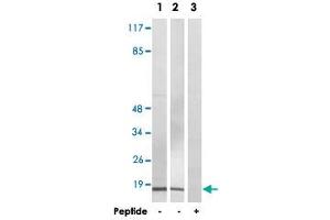 Western blot analysis of extracts from COLO 205 cells (Lane 1 and lane 3) and HeLa cells (Lane 2), using BRP44L polyclonal antibody .