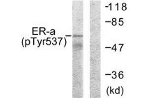 Western blot analysis of extracts from 293 cells, using Estrogen Receptor-alpha (Phospho-Tyr537) Antibody. (Estrogen Receptor alpha antibody  (pTyr537))