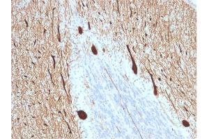 Immunohistochemistry (IHC) image for anti-Carbonic Anhydrase VIII (CA8) antibody (ABIN6940916)