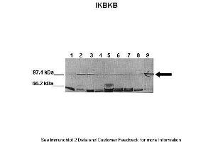 Western Blotting (WB) image for anti-Inhibitor of kappa Light Polypeptide Gene Enhancer in B-Cells, Kinase beta (IKBKB) (N-Term) antibody (ABIN2779787)