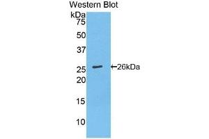 Detection of Recombinant Bcl2, Mouse using Polyclonal Antibody to B-Cell Leukemia/Lymphoma 2 (Bcl2) (Bcl-2 antibody  (AA 2-208))