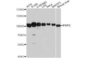 Western blot analysis of extracts of various cell lines, using PARG antibody. (PARG antibody  (AA 777-976))