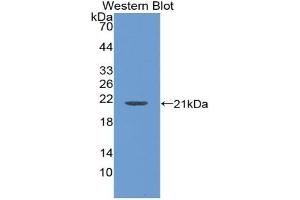 Detection of Recombinant LCN1, Rat using Polyclonal Antibody to Lipocalin 1 (LCN1) (Lipocalin 1 antibody  (AA 22-173))